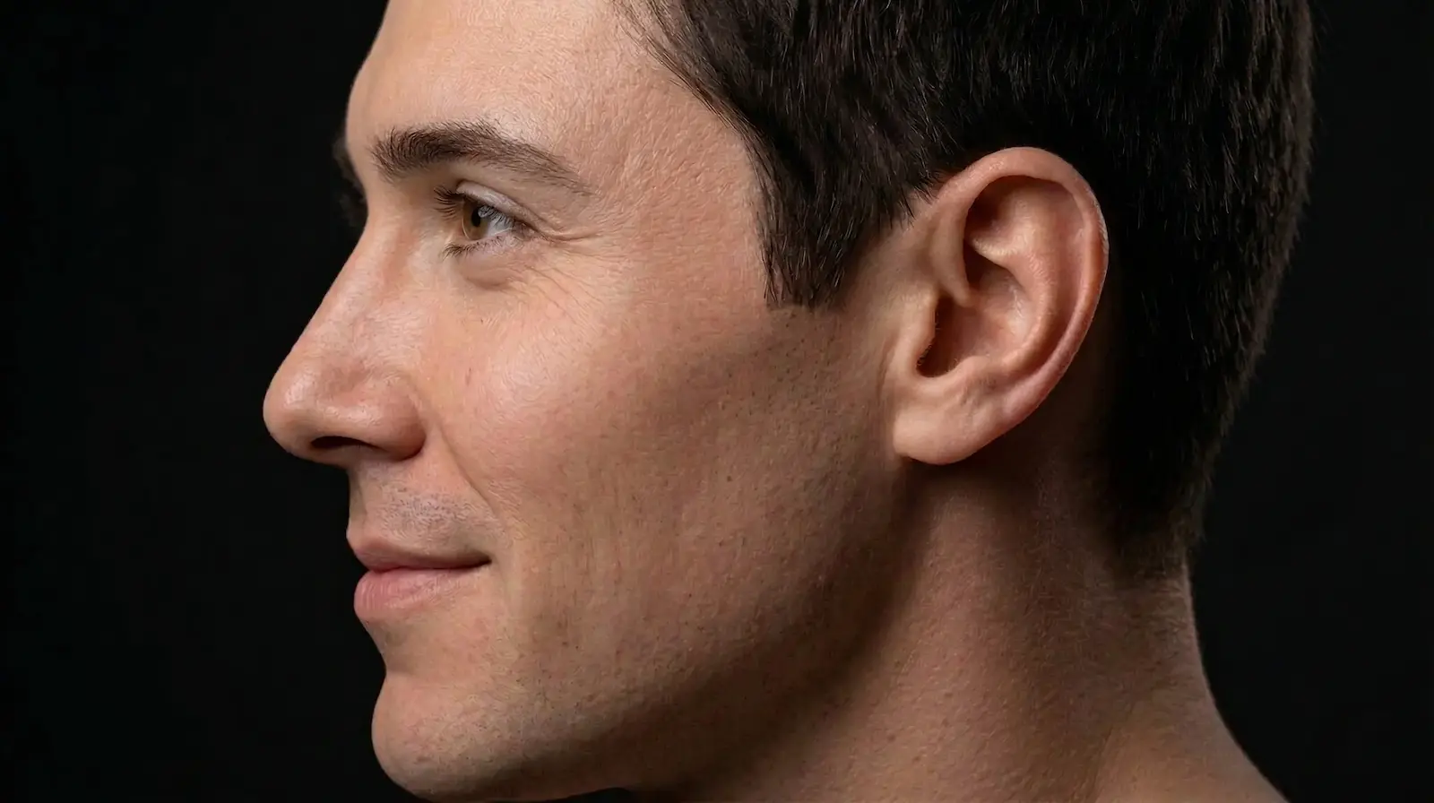 Resultado de otoplastia en Cali para corrección de orejas, logrando simetría y armonía facial con el Dr. Jaime Arias.